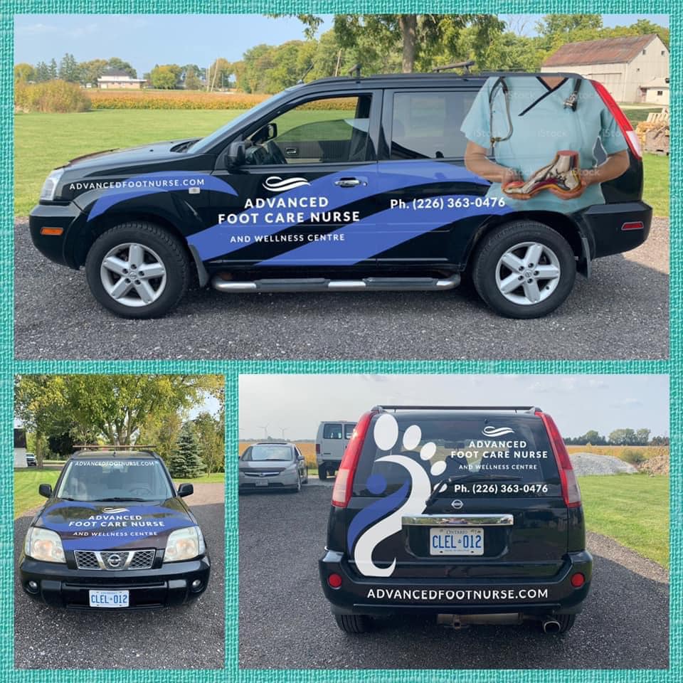 Why Consider Mobile Care? Advanced Foot Care Nurse and Wellness Foot Care Nurse in