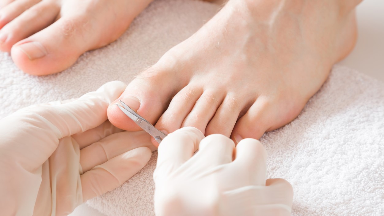 Who Can Benefit from Nail Reconstruction? Advanced Foot Care Nurse