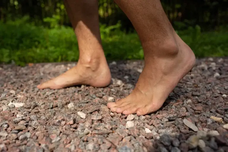 What do I do about my overlapping and bent toes