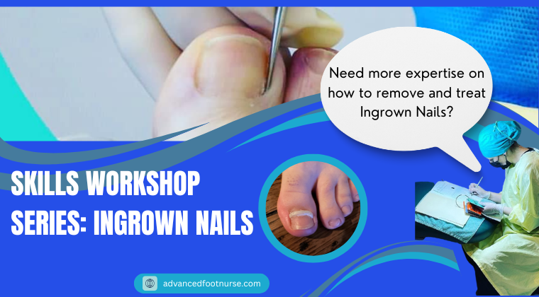 Foot Care Skills Workshop Ingrown Nail Care