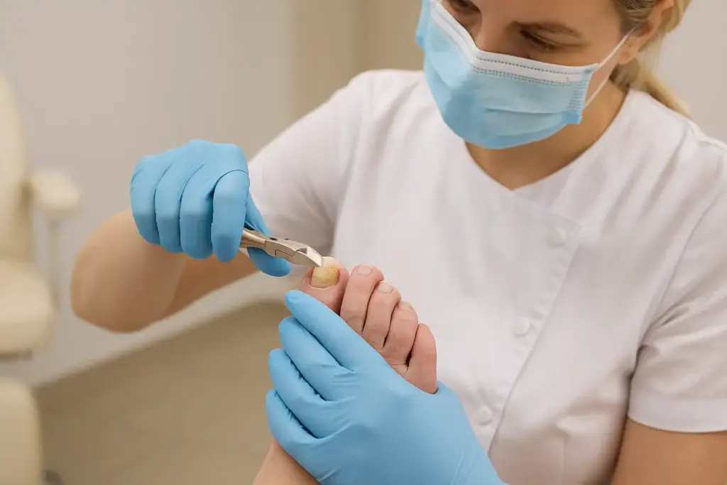 Who Needs a Foot Nurse Thick Nails That Are Hard to Cut