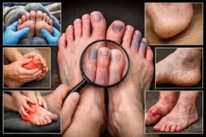 When Your Feet Speak Up Signs of Poor Circulation You Shouldn’t Ignore